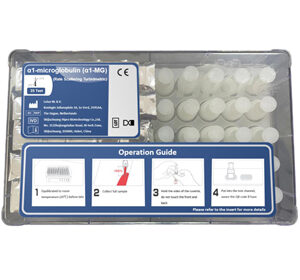 α1-microglobulin (α1-MG) Test