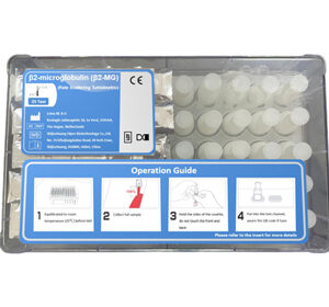 β2-microglobulin (β2-MG) Test