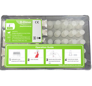 D-Dimer Test