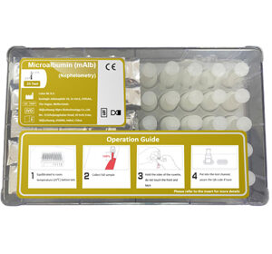 Microalbumin (mAlb) Test