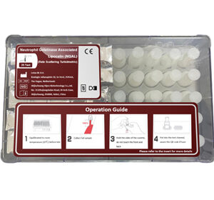 Neutrophil Gelatinase Associated Lipocalin (NGAL) Test